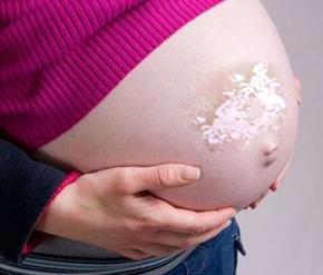 孕妇患白癜风会有哪些危害